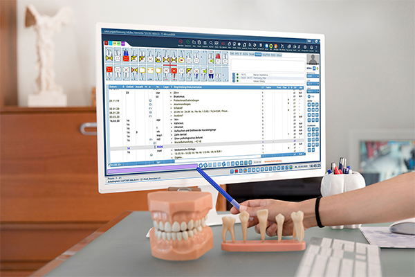 Zahnmedizinische Software auf einem Monitor mit Zahnmodellen im Vordergrund